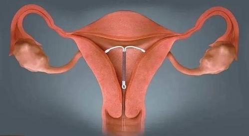 上环视频观看,视频揭秘女性生殖健康新视角