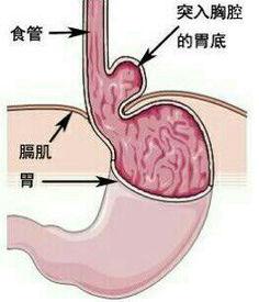 食道镜视频,食道健康全景扫描